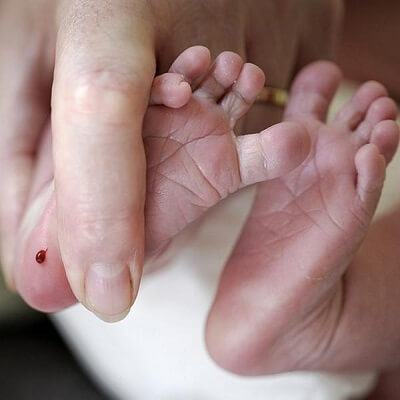 Vì sao phải lấy máu gót chân trẻ sơ sinh? 4