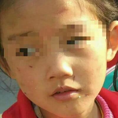 Bạo hành trẻ em: Mẹ đánh đập con đến tróc hết cả tóc 7