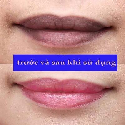 Cách trị thâm môi bằng kem đánh răng siêu hiệu quả 3