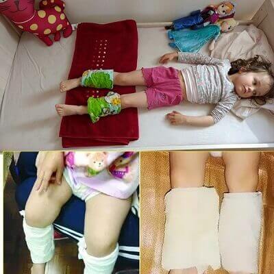 Quấn khăn ở chân là cách hạ sốt cho trẻ phổ biến của mẹ Tây 5