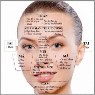 Vị trí mụn trên mặt nói lên điều gì về sức khỏe? 3