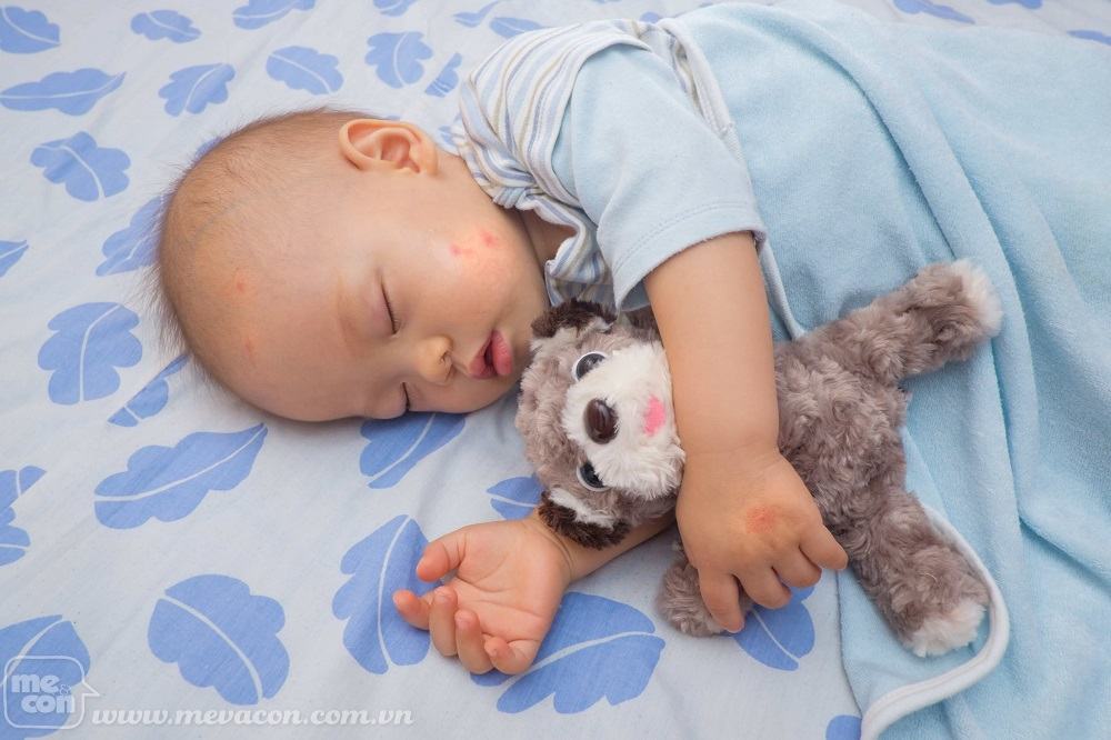 Các bệnh thường gặp ở trẻ sơ sinh ngày nắng nóng 6