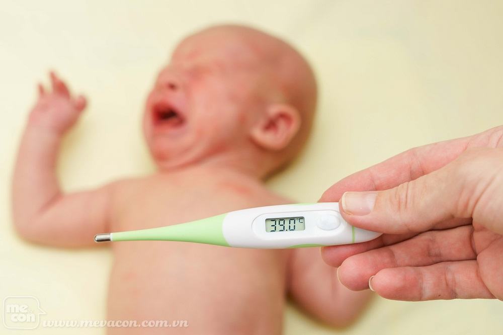 Các bệnh thường gặp ở trẻ sơ sinh