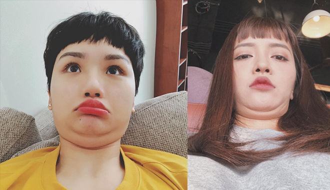 xóa nọng cằm