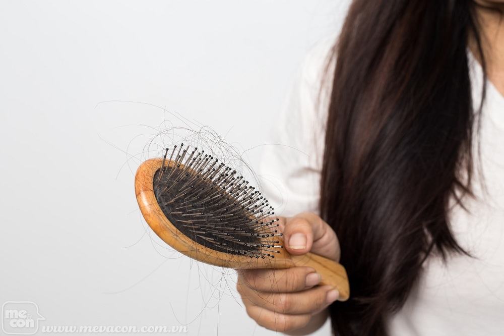 Cách trị rụng tóc sau sinh hiệu quả tại nhà 33 Cách trị rụng tóc sau sinh