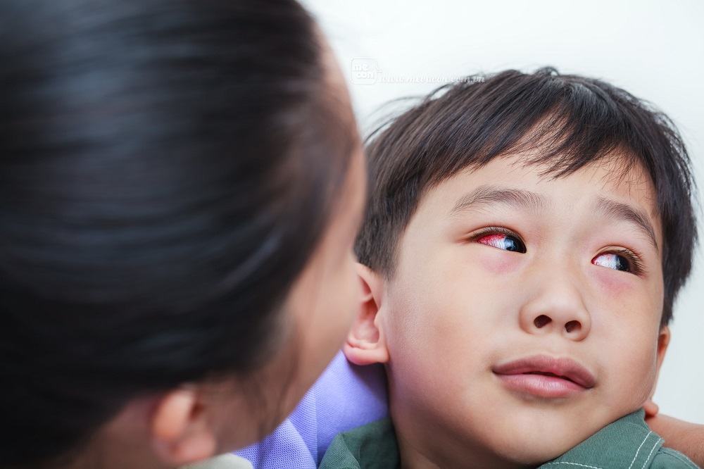 Các bệnh thường gặp ở trẻ khi giao mùa và cách phòng bệnh 36 Các bệnh thường gặp ở trẻ khi giao mùa