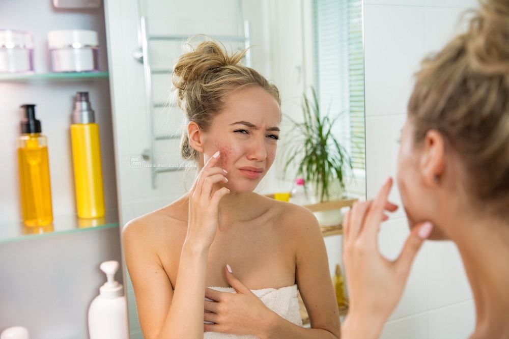 làm sao để chống lão hóa da