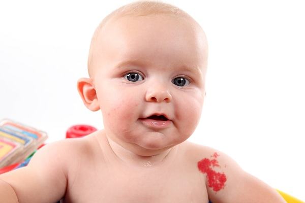 Vết bớt nói lên điều gì về số phận sau này của trẻ nhỏ 5