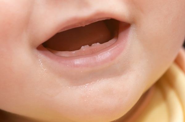 Lịch mọc răng ở trẻ nhỏ mẹ đã biết hay chưa? 5