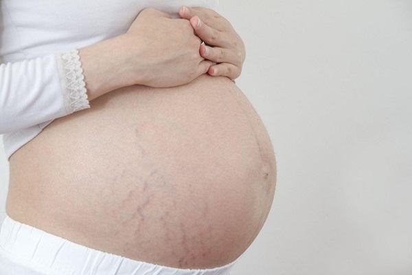 Tăng cân trong thai kỳ như thế nào cho hợp lý 35 Tăng cân trong thai kỳ như thế nào cho hợp lý 7