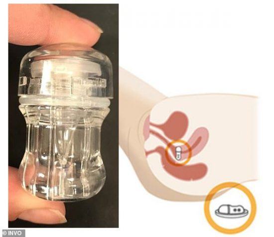 Cặp đôi đồng tính mang thai con trai nhờ thụ tinh trong ống nghiệm 37 Cặp đôi đồng tính mang thai con trai nhờ thụ tinh trong ống nghiệm 9