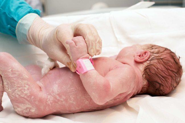 Chỉ số Apgar – Bài kiểm tra sức khỏe đầu tiên của trẻ sơ sinh 34 Chỉ số Apgar – Bài kiểm tra sức khỏe đầu tiên của trẻ sơ sinh 6