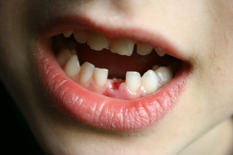 20 bí mật thú vị về những chiếc răng sữa 36 20 bí mật thú vị về những chiếc răng sữa 8