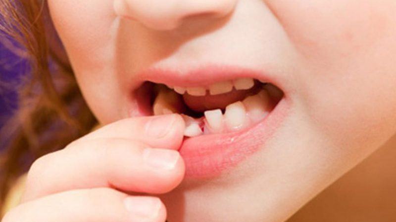 20 bí mật thú vị về những chiếc răng sữa 37 20 bí mật thú vị về những chiếc răng sữa 9