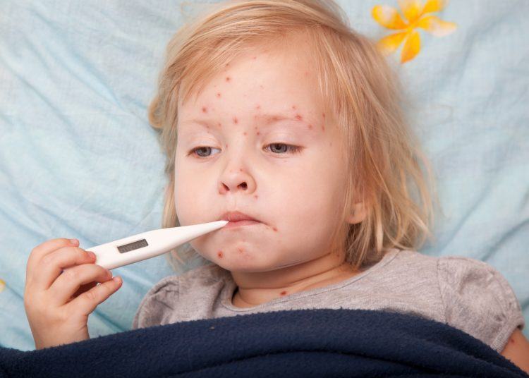 Bệnh sốt xuất huyết và những sai lầm từ phụ huynh 36 Bệnh sốt xuất huyết và những sai lầm từ phụ huynh 8