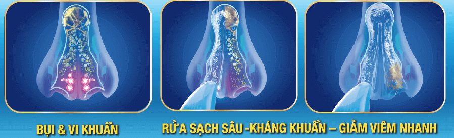 bảo vệ khoang mũi