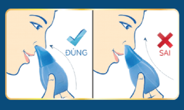 Mách mẹ những phát hiện thú vị về… chiếc mũi 39 bảo vệ mũi trong thời tiết giao mùa