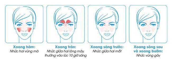 bệnh viêm mũi và viêm xoang1