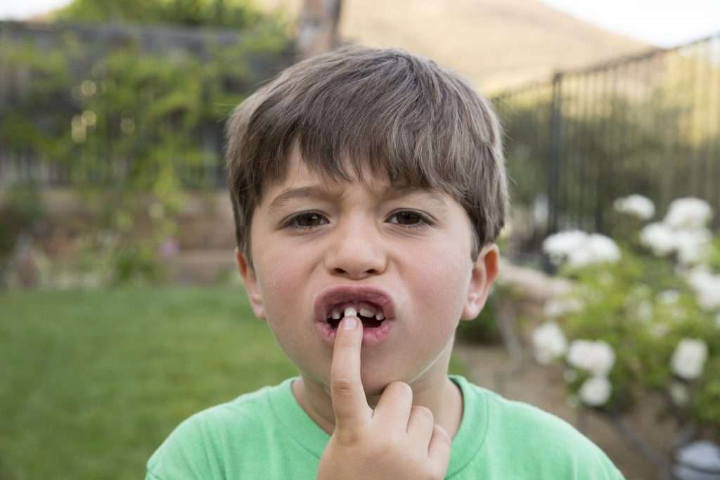Bật mí bạn 3 căn bệnh răng miệng thường gặp nhất ở trẻ nhỏ! 3