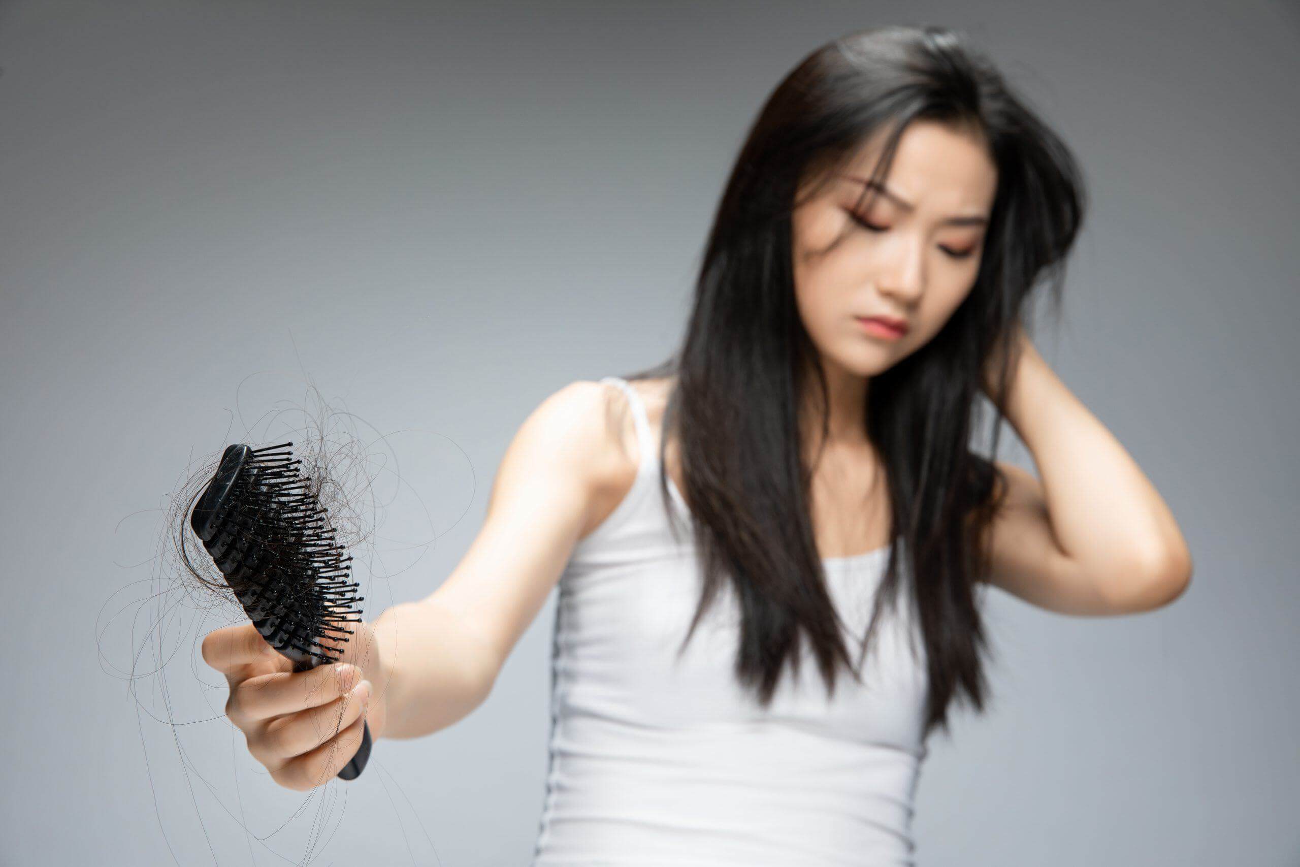 Bạn có biết, cơ thể mẹ thay đổi như thế nào sau khi sinh em bé? 40 rụng tóc