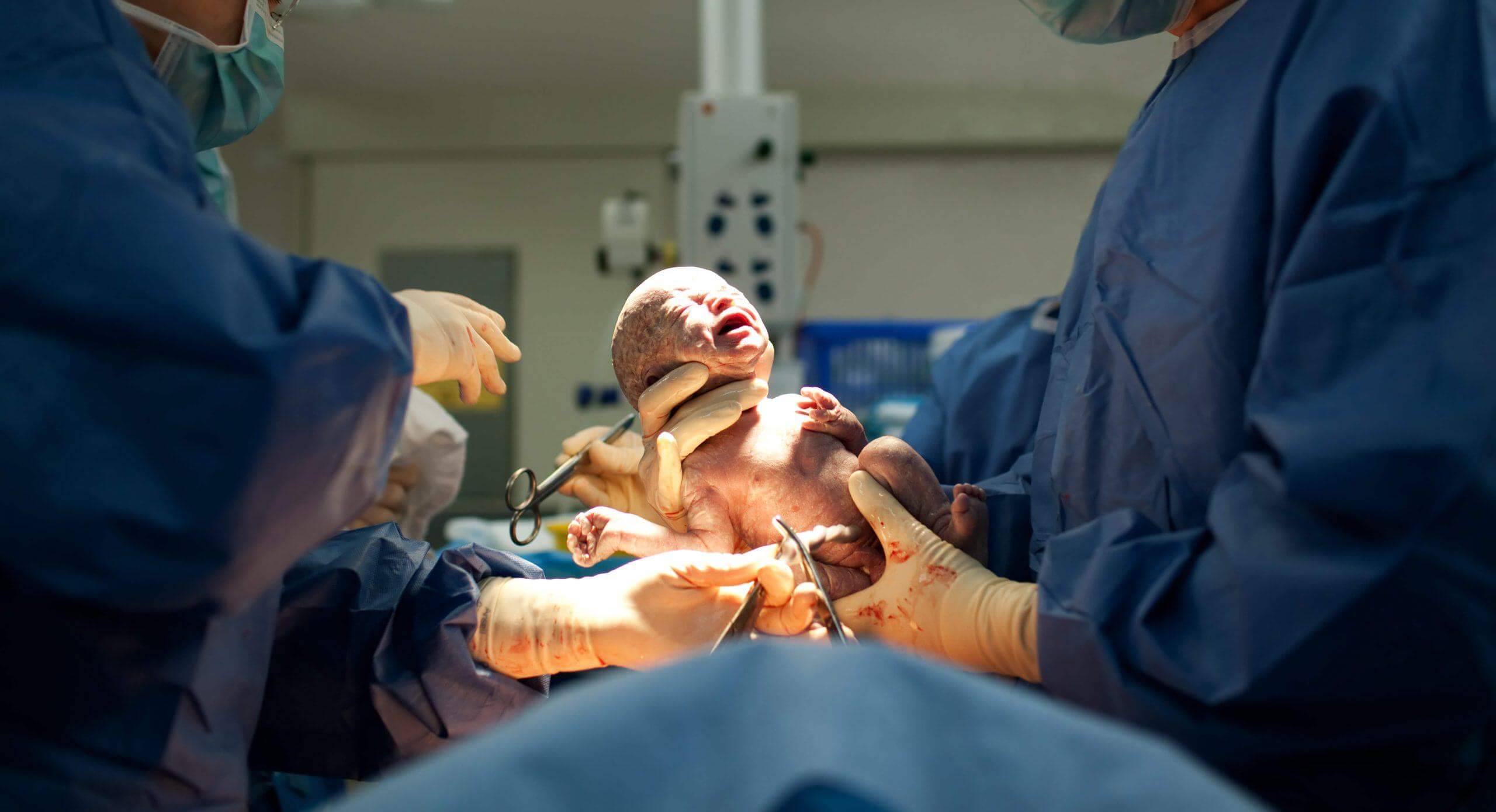 Giúp mẹ giải đáp thắc mắc: Sinh mổ lần 4 có nguy hiểm không? 39 có nhiều biến chứng liên quan đến nhau thai khi sinh mổ nhiều lần
