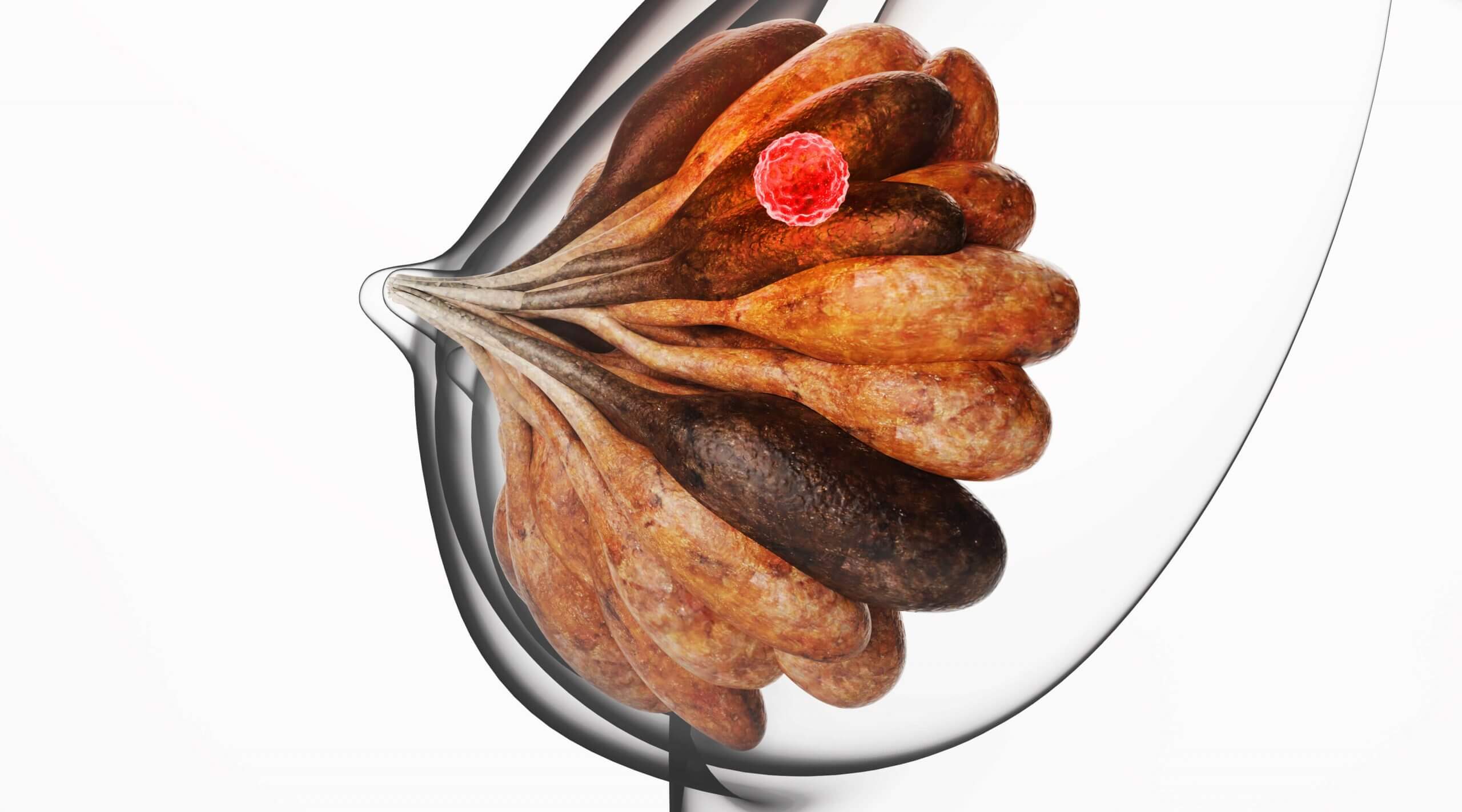 liệu pháp xạ trị 