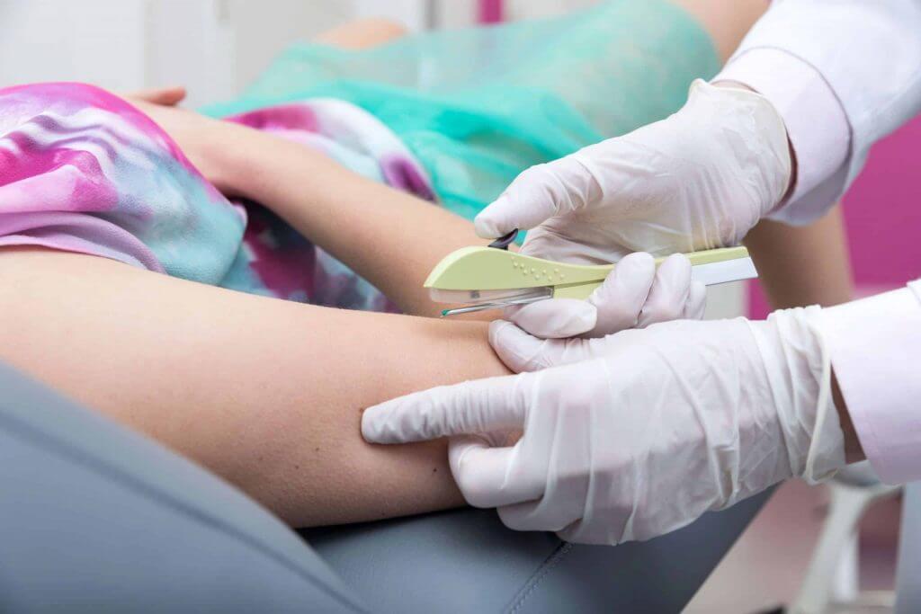 Tổng hợp các biện pháp tránh thai an toàn nhất hiện nay 62 cấy que tránh thai