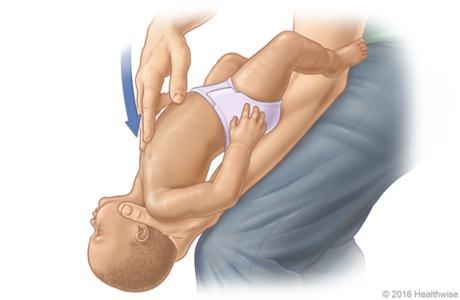 Nôn trớ ở trẻ sơ sinh, mẹ cần làm gì để xử lý và phòng tránh? 36 phương pháp ấn trẻ nôn trớ