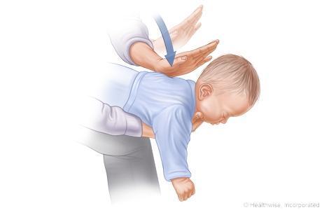 Nôn trớ ở trẻ sơ sinh, mẹ cần làm gì để xử lý và phòng tránh? 35 phương pháp vỗ trẻ nôn trớ