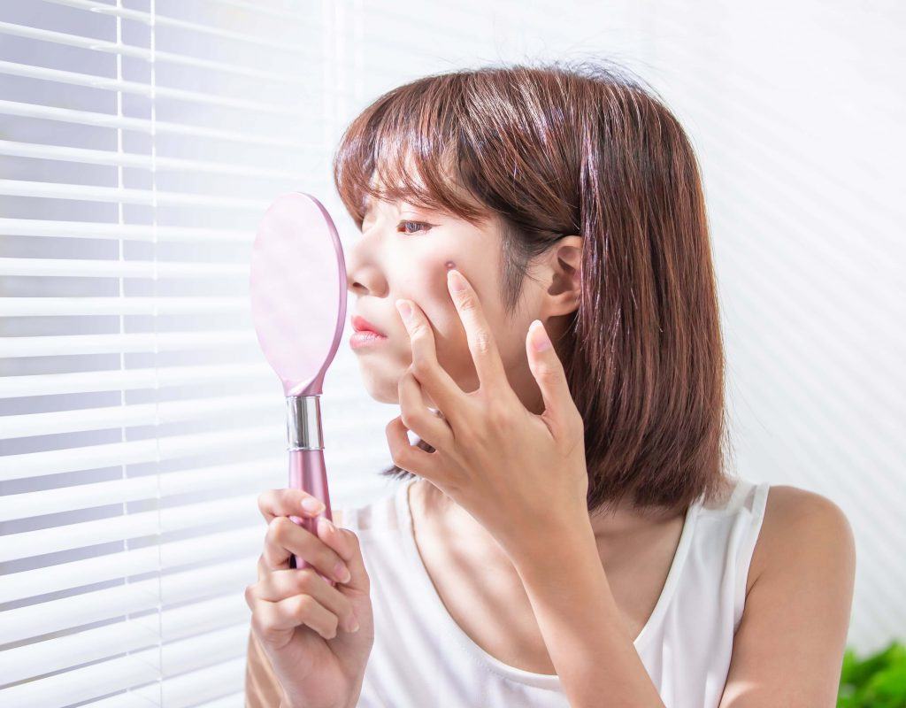 vị trí mụn nói lên điều gì