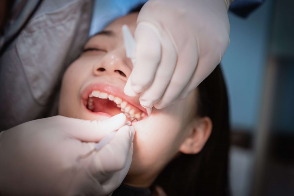 1.001 câu hỏi xoay quanh chuyện nhổ răng khôn ai cũng nên biết 41 nhổ răng khôn kiêng gì