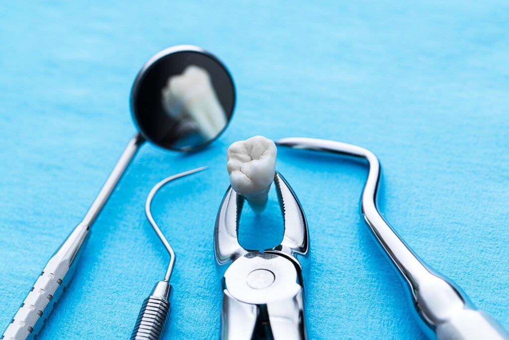 1.001 câu hỏi xoay quanh chuyện nhổ răng khôn ai cũng nên biết 40 biến chứng khi nhổ răng