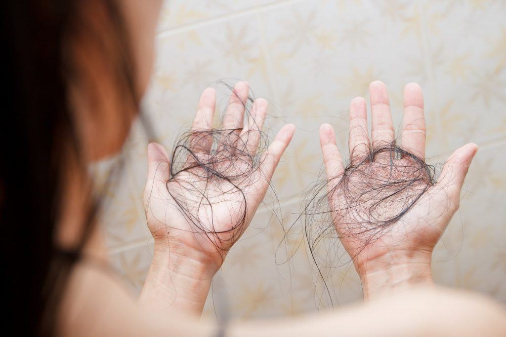 rụng tóc sau sinh