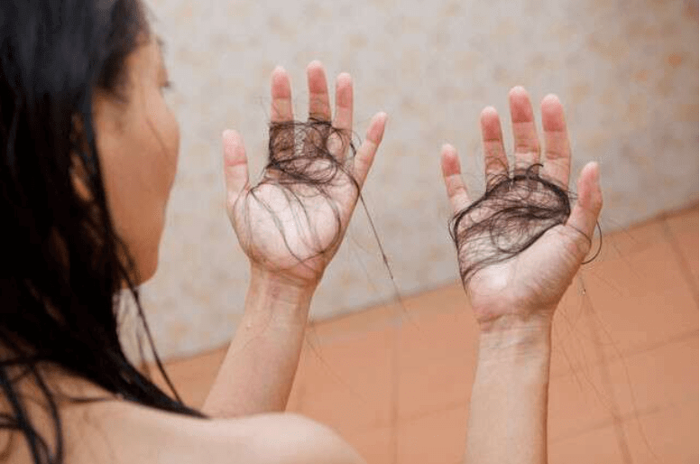 lý do tóc rụng