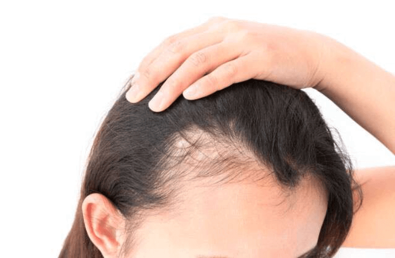lý do tóc rụng 