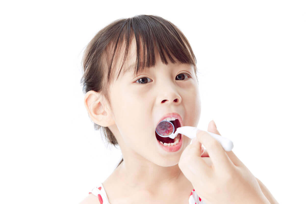 Sâu răng ở trẻ em: 1001 điều bố mẹ cần biết 40 trẻ sâu răng