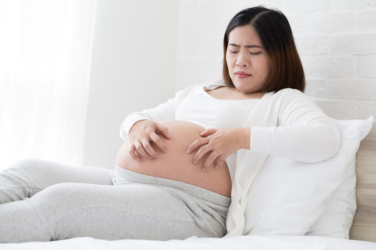 Nổi mề đay khi mang thai có nguy hiểm không và cách điều trị ra sao? 35 mề đay khi mang thai