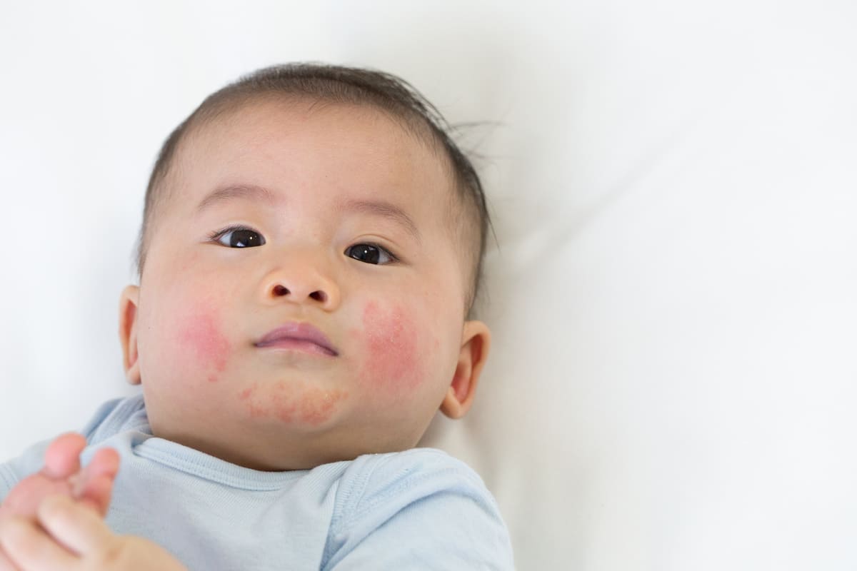 biểu hiện của trẻ sơ sinh