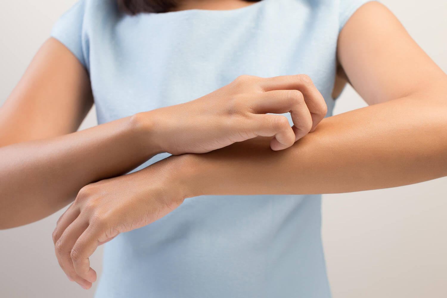 Bỏ túi ngay 5 cách trị mụn lưng tại nhà nhanh chóng, hiệu quả 34 mụn lưng