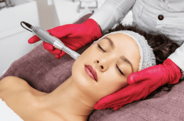 "Lão hóa ngược" với Microneedling, bạn đã biết? 36 microneedling lăn kim vi điểm