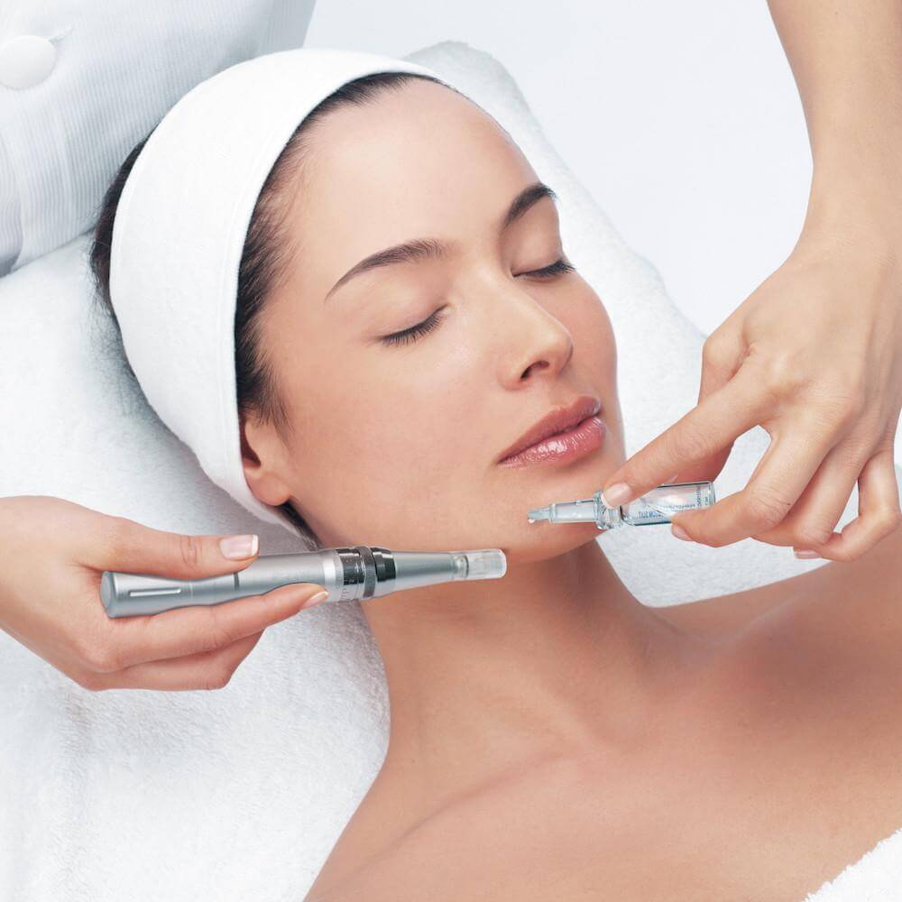 "Lão hóa ngược" với Microneedling, bạn đã biết? 35 lăn kim vi điểm
