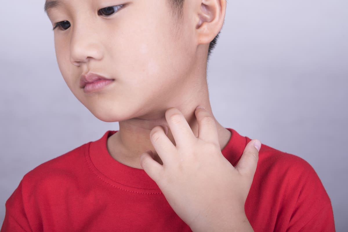 Viêm da dị ứng do cơ địa từ nay sẽ không còn làm mẹ đau đầu nữa 38 biểu hiện viêm da dị ứng