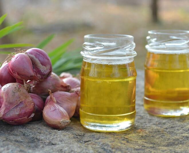 Dầu hành tím, "thần dược" dưỡng tóc suôn mượt ít người biết 35 dầu hành tím
