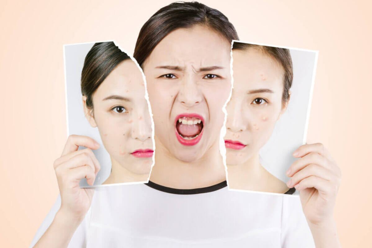 Triệu chứng đa nang buồng trứng đa nang buồng trứng
