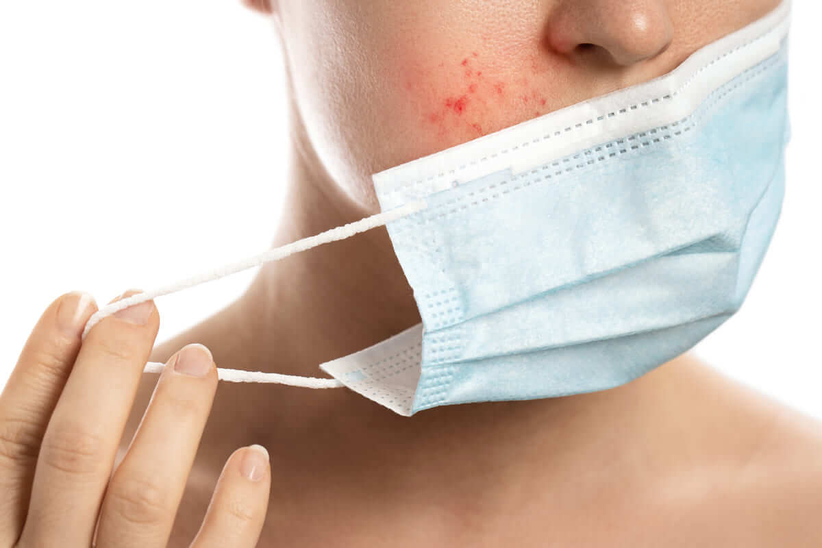 đeo khẩu trang bị mụn đeo khẩu trang bị mụn