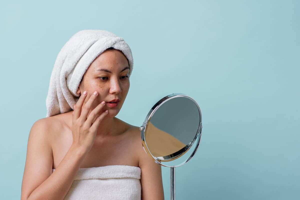 Đeo khẩu trang bị mụn phải làm sao Đeo khẩu trang bị mụn phải làm sao
