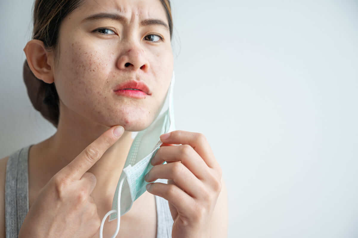 da nào dễ bị nổi mụn khi đeo khẩu trang da nào dễ bị nổi mụn khi đeo khẩu trang