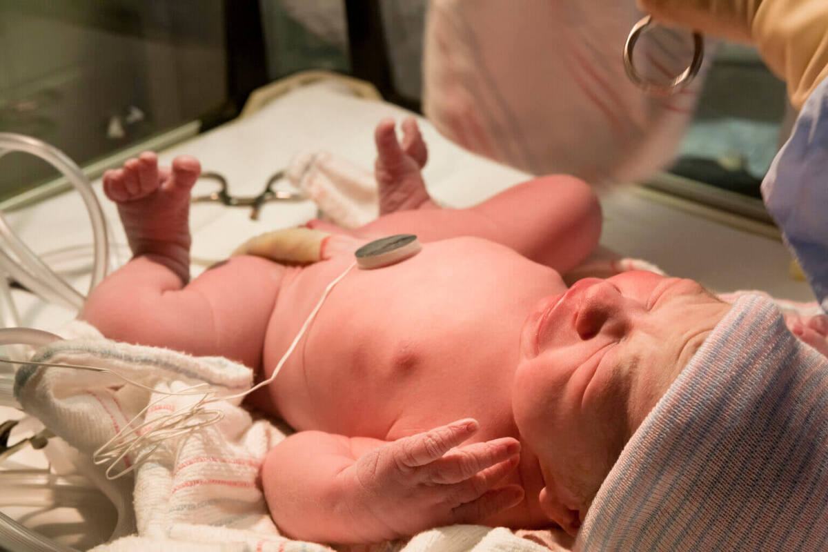 Vệ sinh rốn cho trẻ sơ sinh và những điều mẹ nhất định phải lưu ý 35 rốn trẻ sơ sinh