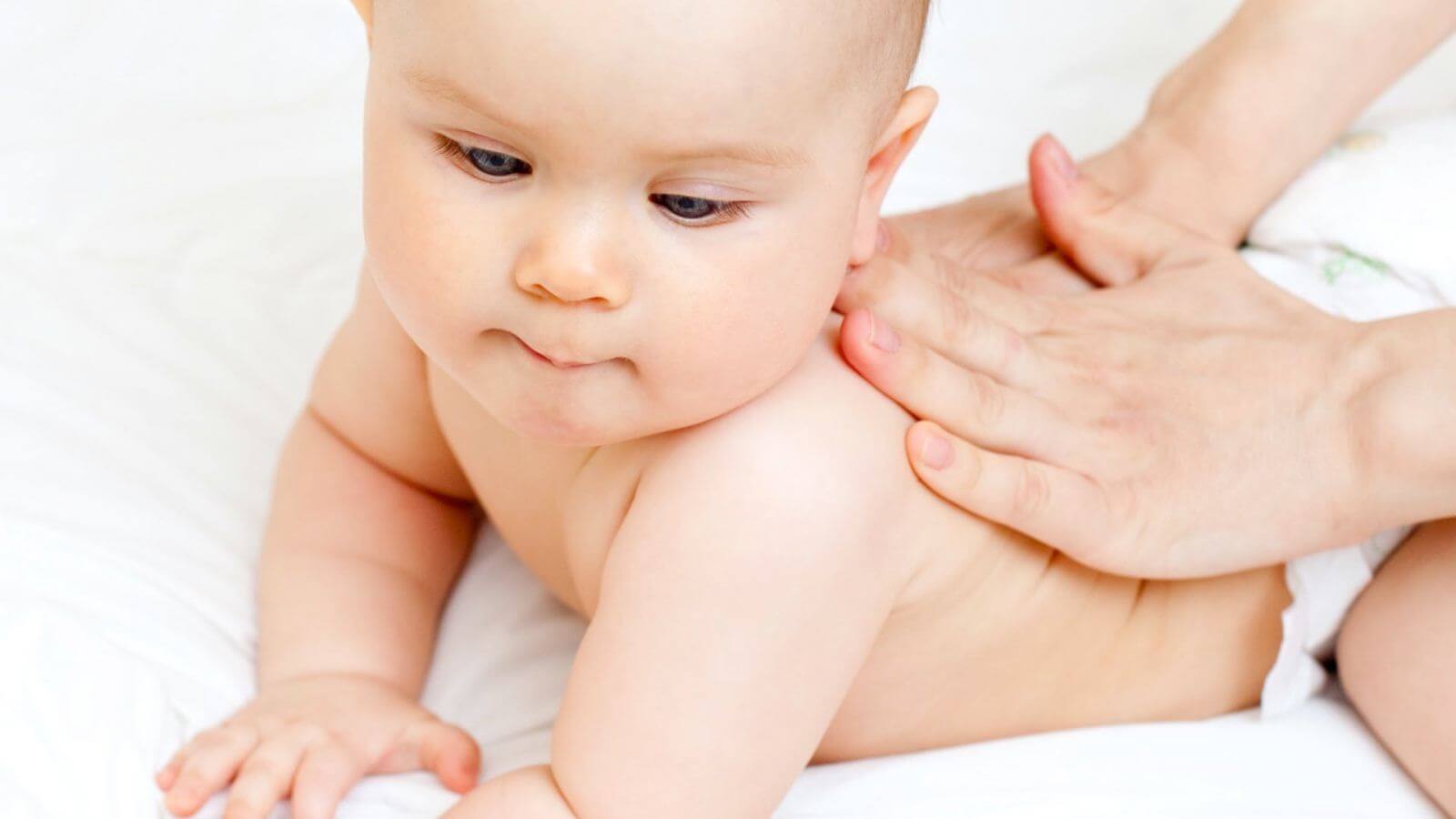 Trẻ bị rôm sảy Trẻ bị rôm sảy