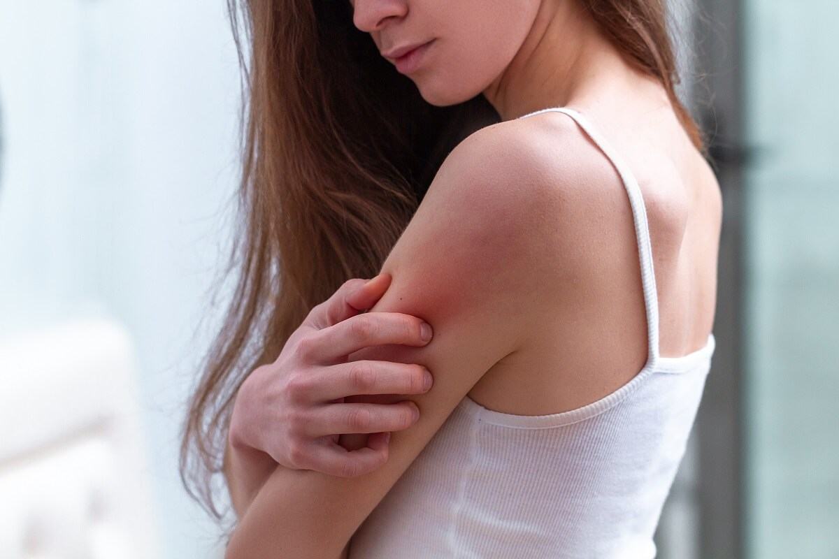 Dị ứng thời tiết là gì Dị ứng thời tiết là gì